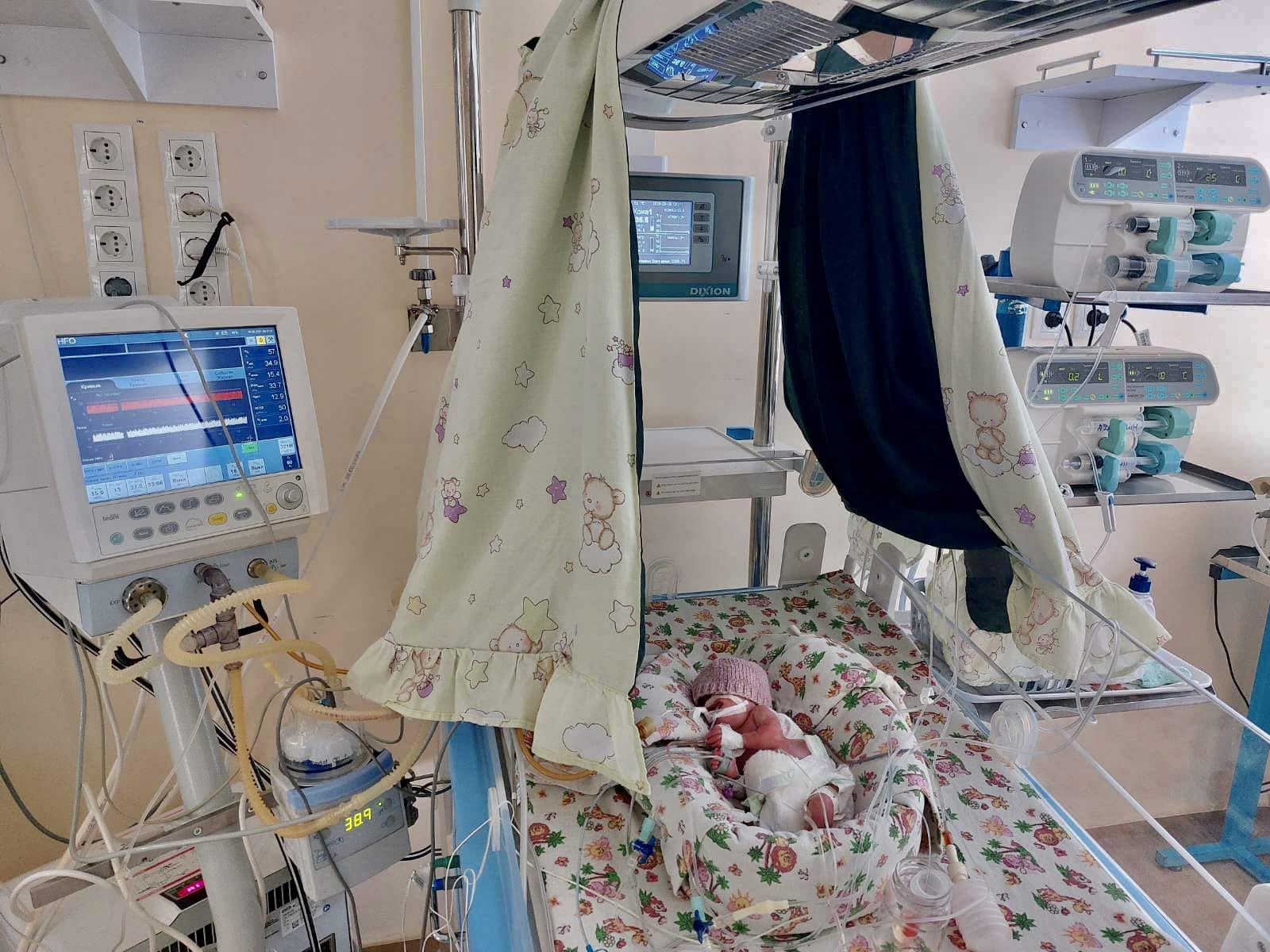 Odesa doctors performed heart surgery on a prematurely born child